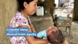 Desnutrición en Camotán, Guatemala.