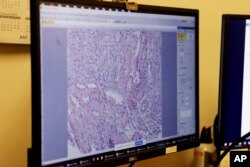 Researchers at NYU Langone Health examine cells from a pig kidney biopsy after the transplant of the pig's kidney into a brain-dead man in New York on July 28, 2023. (AP Photo/Shelby Lum)