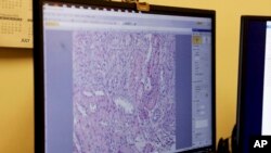 Researchers at NYU Langone Health examine cells from a pig kidney biopsy after the transplant of the pig's kidney into a brain-dead man in New York on July 28, 2023. (AP Photo/Shelby Lum)