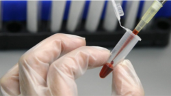 Aumentan casos de VIH en la comunidad latina de EEUU