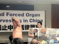 法輪功學員程佩明2024年7月3日在華盛頓舉行的新聞發佈會上展示活摘器官手術在其身體留下的一條長達35釐米的疤痕。（美國之音薛小山拍攝）