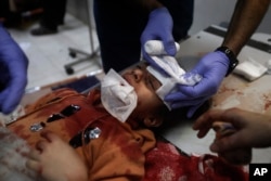 A Palestinian girl wounded in the Israeli bombardment of the Gaza Strip receives treatment at a hospital in Khan Younis, Dec. 18, 2023.