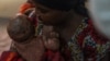 A woman dries her baby suffering from a severe form of mpox at the Kavumu hospital, 30 km north of Bukavu in eastern Democratic Republic of Congo, Aug. 24, 2024. 