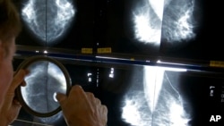 FILE - A radiologist uses a magnifying glass to check mammograms for breast cancer in Los Angeles, May 6, 2010. 