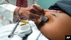 FILE - A doctor uses a hand-held probe on a pregnant woman to measure the heartbeat of her fetus, in Jackson, Mississippi, Dec. 17, 2021.