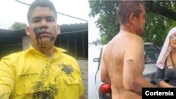 Militantes del partido del candidato a la primaria presidencial de la oposición, Henrique Capriles, denunciaron agrsiones en el estado Apure.