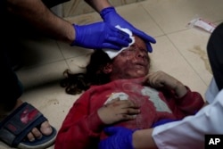 A Palestinian girl wounded in the Israeli bombardment of the Gaza Strip is treated in a hospital in Deir al-Balah, Nov. 14, 2023.