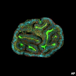 This microscope image provided by researchers in March 2024 shows a kidney organoid resembling renal tubules, created from cells collected from amniotic fluid. (Giuseppe Calà, Paolo De Coppi, Mattia Gerli via AP)
