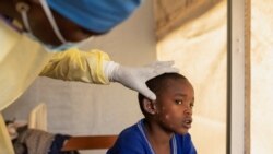 La situation du mpox ne "s'est pas améliorée" à Goma, selon Jean Claude Nzay de Corus International