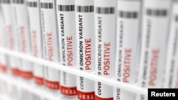 Arxif fotosu - 2022-ci il yanvarın 15-də çəkilmiş bu fotoda COVID-19-un Omicron variantının "müsbət" test nəticəsi yazılan sınaq boruları göstərilir. 