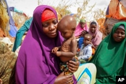 FILE - Nunay Mohamed, 25, who fled the drought-stricken Lower Shabelle area, holds her 1-year-old malnourished child at a makeshift camp for the displaced near Mogadishu, Somalia, June 30, 2022.