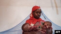 Habibo Abdi Hassan, 21 ans, tient son jumeau dans ses bras au centre de stabilisation Sahal Macalin Ciise à Baidoa, en Somalie, le 14 février 2022.