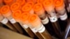 FILE - Test tubes filled with samples of bacteria to be tested are seen at the Health Protection Agency in north London.
