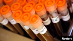 FILE - Test tubes filled with samples of bacteria to be tested are seen at the Health Protection Agency in north London.