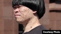 來自香港、現移居台北的瀕死藝術家陳偉霖天生患有皮膚癌，全身長滿黑色素腫瘤。(美國之音特約記者方琦拍攝)