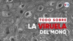 Todo sobre la viruela del mono