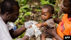 FILE - A child affected by monkeypox, sits on his father's legs while receiving treatment at a center run by Doctors Without Borders, in Zomea Kaka, in Lobaya region, Central African Republic, Oct. 18, 2018.
