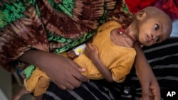 Hamdi Yusuf, a malnourished child, is held by her mother in Dollow, Somalia, Sept. 21, 2022.