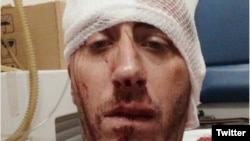 Novinar Vladimir Kovačević je teško pretučen 26. augusta u Banja Luci