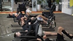 Чим відрізняється фізична реабілітація в Україні та США, розповідає координаторка Protez Academy.Відео
