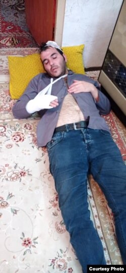 آثار شکنجه جلال ژاله، معترض بازداشت شده در کرمانشاه