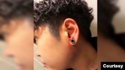 A Thai student in San Francisco, Rujira Amboon, is pictured with her left ear injury after getting attacked on the San Francisco Bus on Dec 11, 2022.