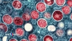 CDC Mỹ hỗ trợ Việt Nam phòng chống đậu mùa khỉ