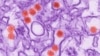 Experimental Zika Vaccine Protects Monkeys