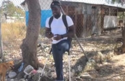 This resident represents the deaf members of the camp. He also lost a leg in the earthquake. (Matiado Vilme/VOA Creole)
