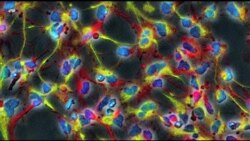 Researchers Seek Ways to Help Damaged Brains Heal