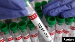 Une éprouvette étiquetée « mpox virus - positif » est tenue par un travailleur de la santé, le 20 août 2024. Reuters / Dado Ruvic