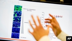 Data about the Ebola virus is displayed at a lab that will be used to test for treatments against the coronavirus at U.S. Army Medical Research and Development Command at Fort Detrick, Md., Thursday, March 19, 2020.