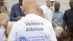 Malawi: les autorités distribuent des gadgets de sécurité aux albininos