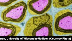 Supportive Schwann cells (green) surround the conductive axon (purple) of a neuron in the peripheral nervous system in this artificially colored image.