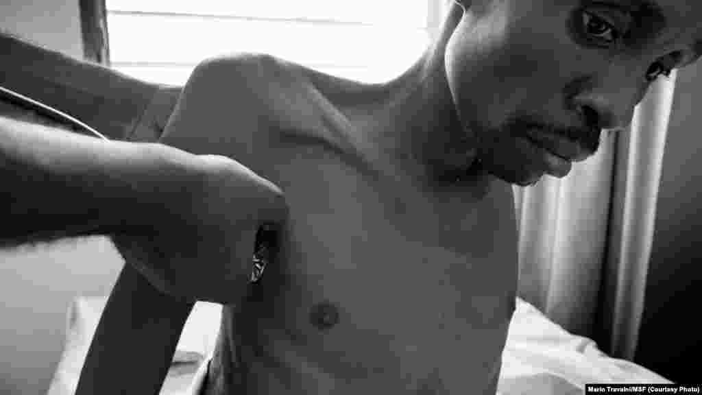 André, 42, photographed in the HIV-AIDS ward of the Centre Hospitalier Kabinda in Kinshasa, DRC, Jan. 24, 2012. (MSF/Mario Travaini)