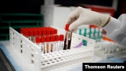 Imagen de un estudio de vacunas contra la COVID-19 que realizan los Cetros de Investigación de EE.UU., en California, el 2 de octubre de 2020.