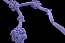 U.S. public health officials are urging doctors and nurses around the world to be on the lookout for a highly drug-resistant yeast strain called Candida auris. (Photo courtesy of CDC)