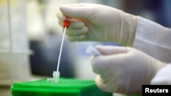 An employee shows testing for the coronavirus at a medical laboratory in Cologne, Germany, March 24, 2020, as the spread of the coronavirus disease (COVID-19) continues.