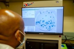 واریانت امیکرون در مقایسه با نوع اصلی ویروس که از ووهان آمد، نزدیک به ۵۰ جهش دارد