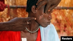 A Nuba woman, injured during a raid by Sudan's air force, sits in a makeshift hospital in South Kordofan in April 2012. 