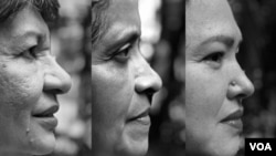 Since 2018, 400,700 women in Venezuela have been diagnosed with breast cancer. According to the Anti-Cancer Society in Venezuela, getting an accurate numbers of patients is unlikely. Since 2012, the Ministry of Health does not offer official figures.