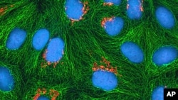 FILE - This undated image made available by the National Institutes of Health and National Center for Microscopy shows cancer cells.