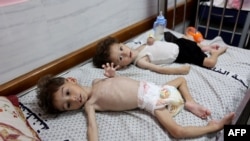 Palestinian children Uday, left, and Mohammed Mahra, both suffering from malnutrition, rest at the Kamal Adwan hospital in Beit Lahia in the northern Gaza Strip on July 9, 2024.