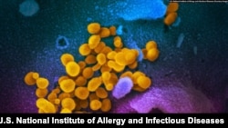 SARS-CoV-2 virions emerge from a human cell after replicating. Despite their apparent longevity, the virions can be destroyed with warm, soapy water. (Courtesy: U.S. National Institute of Allergy and Infectious Diseases)