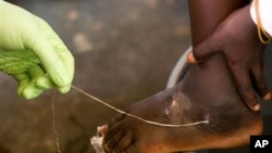 Carter Center in Final Push to Eradicate Guinea Worm Disease