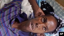 A malnourished Somali refugee at a field hospital of the International Rescue Committee, IRC, in Dadaab, Kenya, Wednesday, Aug. 3, 2011.