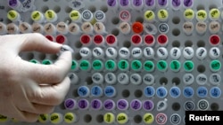 FILE - Human genetic material is shown stored at a laboratory.