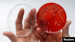 FILE- An employee displays MRSA (Methicillin-resistant Staphylococcus aureus) bacteria inside a petri dish containing agar jelly for bacterial culture in a microbiological laboratory in Berlin.