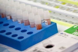 A laboratory technician prepares COVID-19 patient samples for semi-automatic testing at Northwell Health Labs, March 11, 2020, in Lake Success, N.Y.