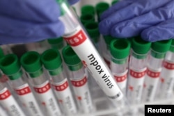 FILE - A test tube labelled "Mpox virus positive" is held in this illustration taken August 20, 2024. (REUTERS/Dado Ruvic/Illustration/File Photo)